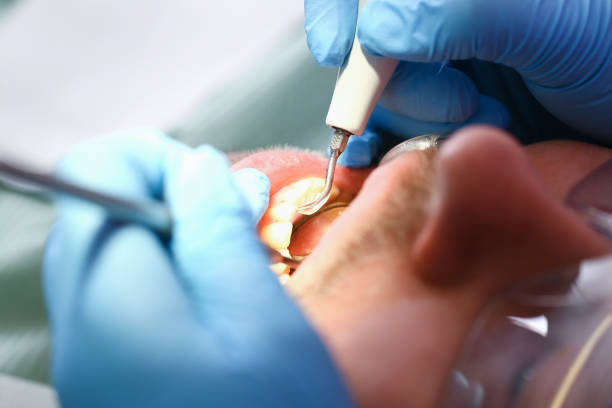 Best Broken Tooth Emergency  in South Dos Palos, CA