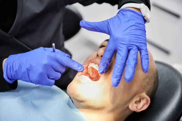 Best Urgent Tooth Repair  in South Dos Palos, CA