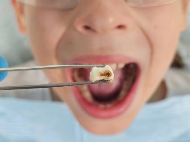 Best Broken Tooth Emergency  in South Dos Palos, CA