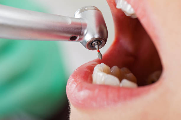 Best Tooth Infection Emergency Dentist  in South Dos Palos, CA
